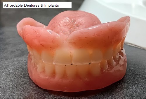 Affordable Dentures & Implants - monroe